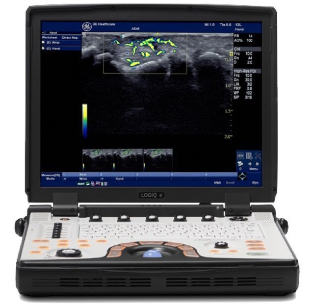 GE Logiq e BT12 Ultrasound for Sale-1